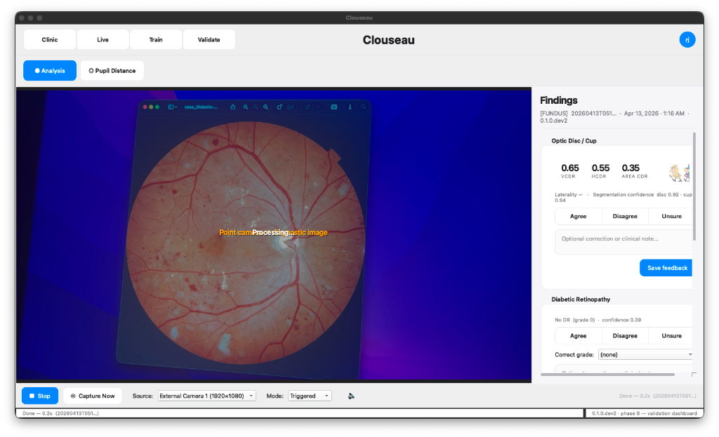Live Fundus Image Lock